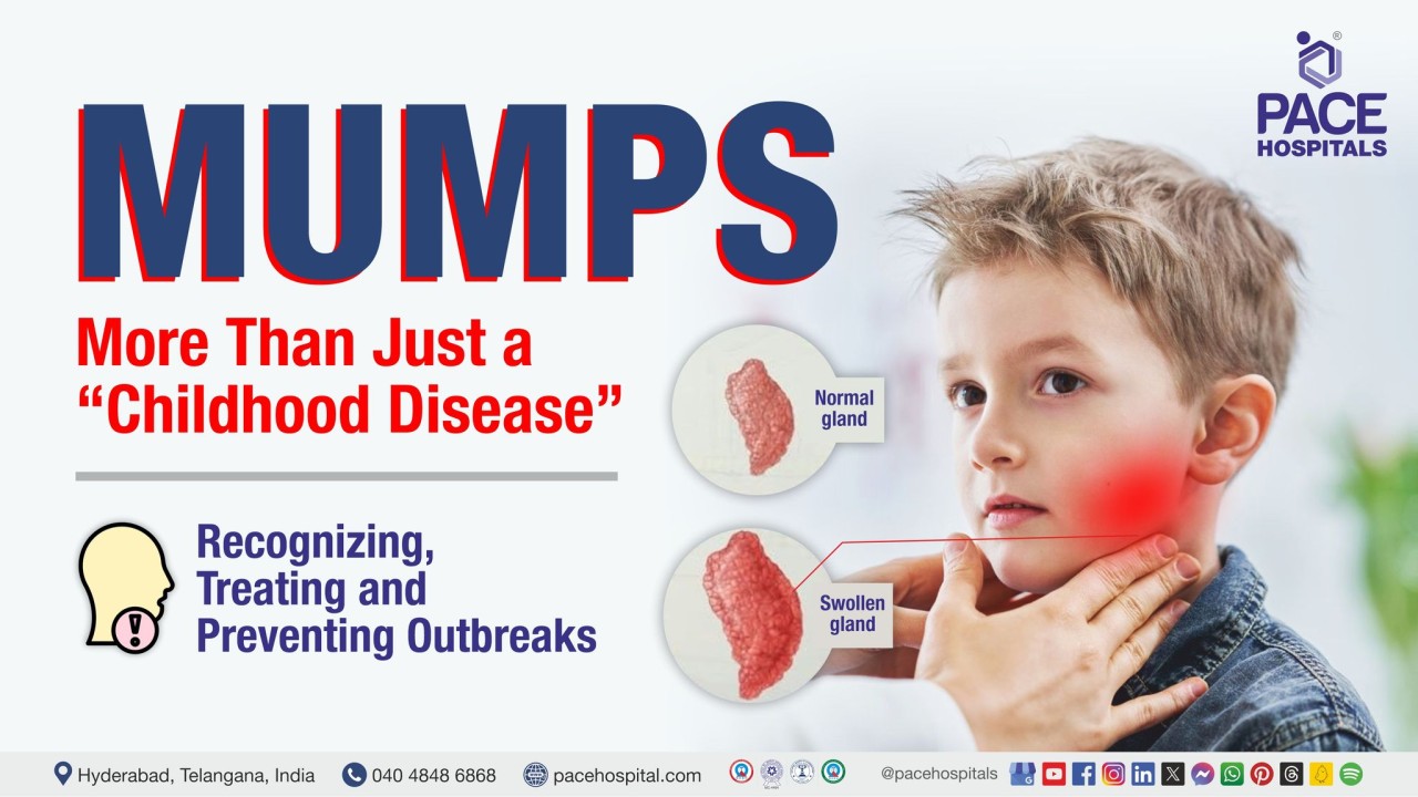 Mumps: More Than Just a "Childhood Disease"