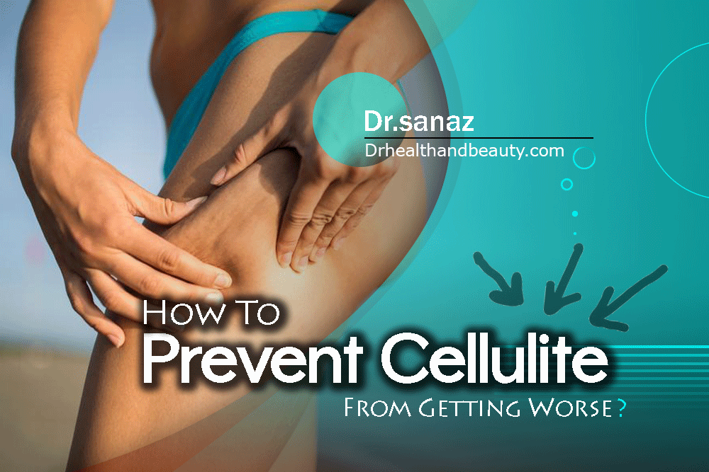 How To Prevent Cellulite From Getting Worse?