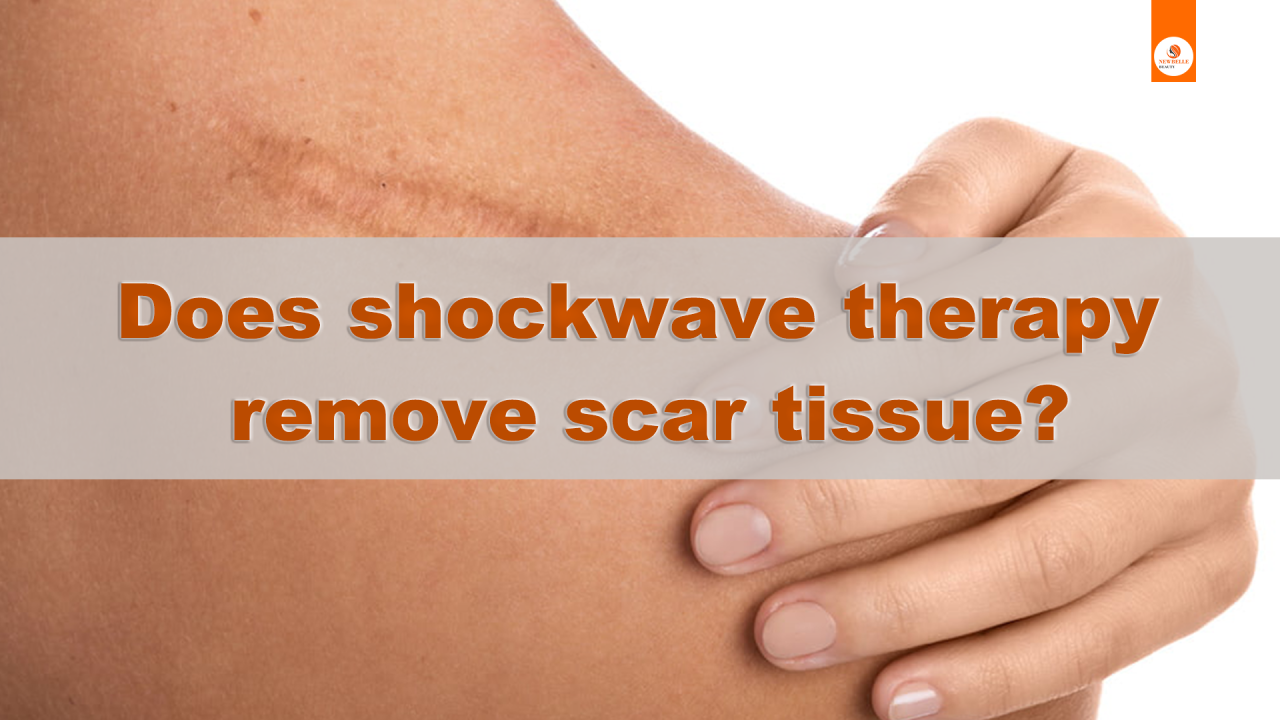 Does shockwave therapy remove scar tissue?