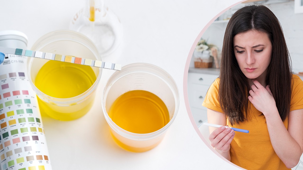 How Does Urine Colour Change During Early Pregnancy?