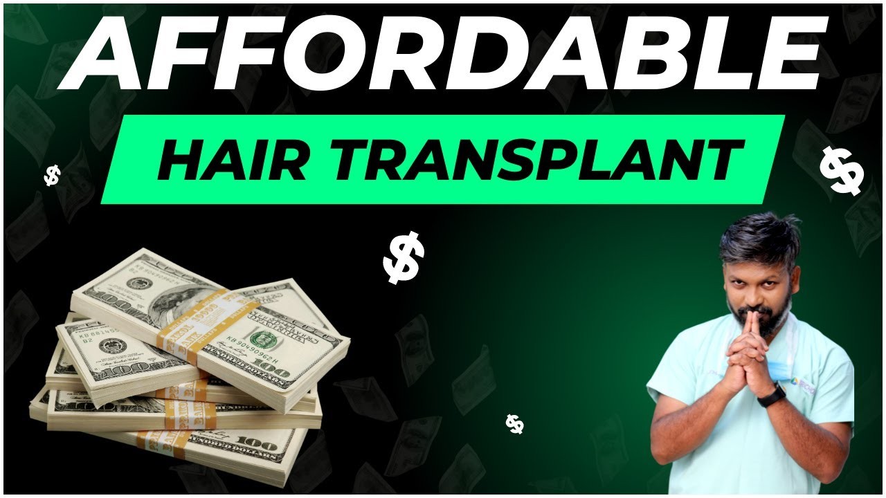 Is hair transplant affordable?