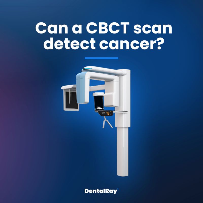 How CBCT scans can detect cancer  DentalRay posted on the topic
