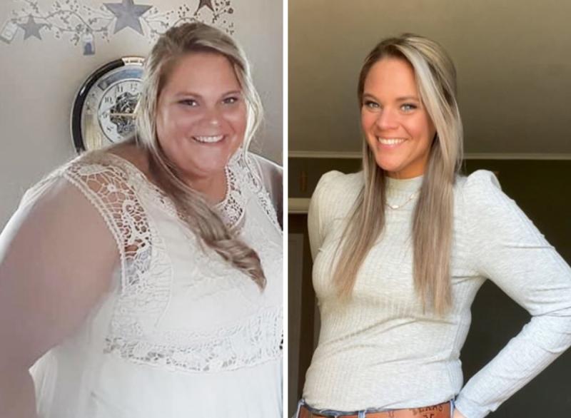 semaglutide success stories before and after 3 from Real Patients Real-Life Semaglutide Success Stories
