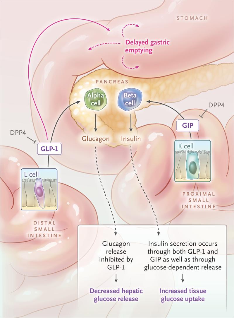 michigan glp-1 pancreatitis law firm office in Nutritional priorities to support GLP-1 therapy for obesity Risk of pancreatic cancer associated glp-1 law office michigan firm