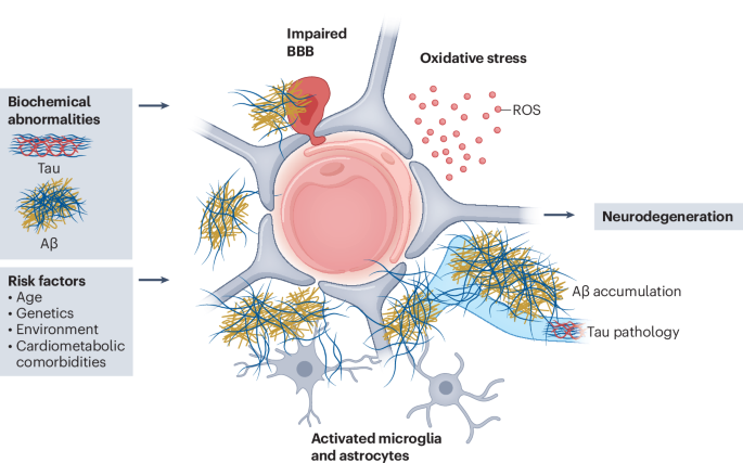glp 1 meds and alzheimer's In New Dementia Trials, Ozempic's 'Miracle Drug' Image Takes a Hit Weight Loss Drugs May Protect