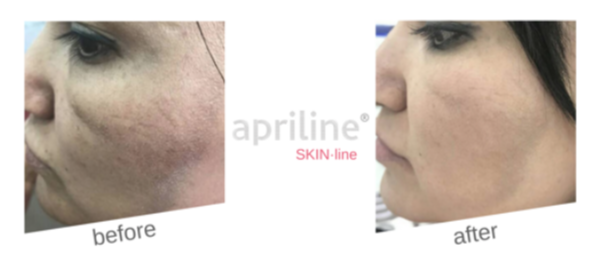 does glutathione reduce melanin Unlock Radiant Skin with L-Glutathione: The Master Antioxidant for a Skin Nutrition SA The glutathione redox cycle, demonstrating