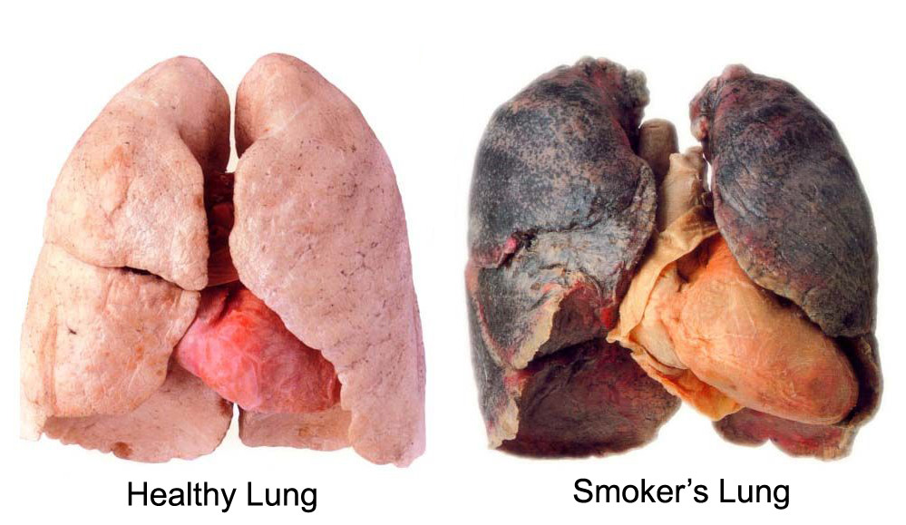 does one cigarette affect your lungs Is All It Takes to Harm Heart, Your Life - Vejthani International Hospital Smoking and its effect on