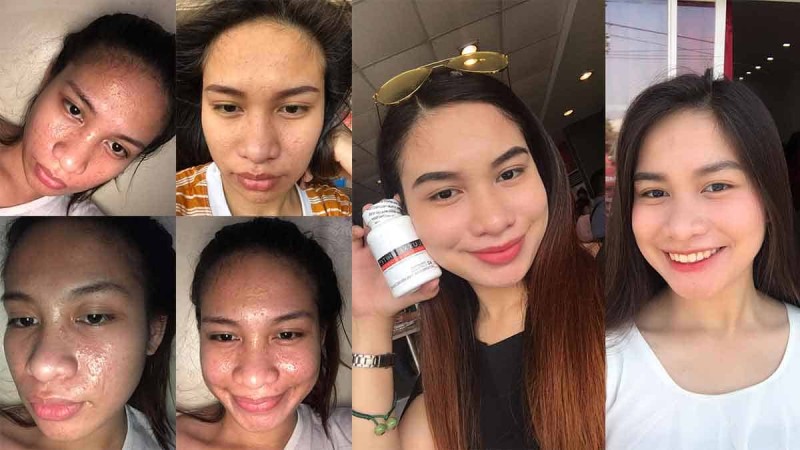 glutathione frontrow Luxxe White Enhanced - International How Effective Frontrow Luxxe White