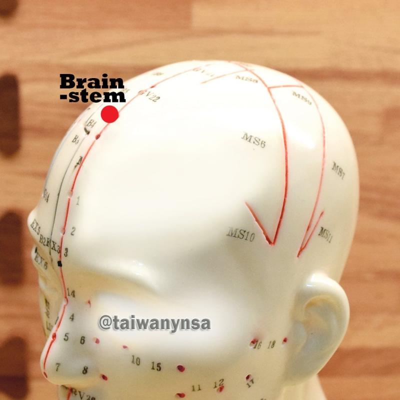 Yamamoto New Scalp Acupuncture - 山元式新頭針療法台灣同好會 Yamamoto New Scalp Acupuncture - 山元式新頭針療法台灣同好會