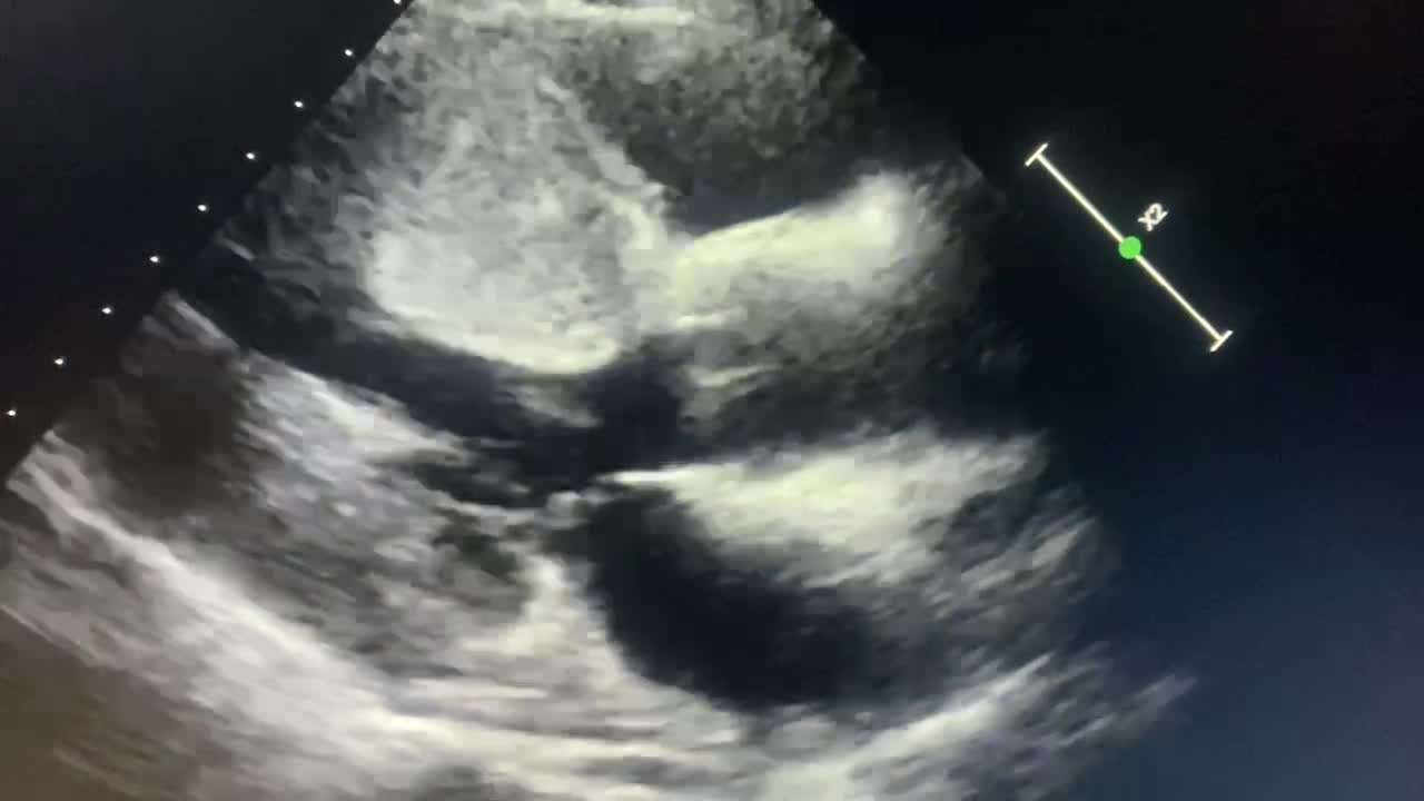 Winston Jones RCS CCT CRAT on LinkedIn: Interesting case wowzers Winston Jones RCS CCT CRAT on LinkedIn: Interesting case wowzers