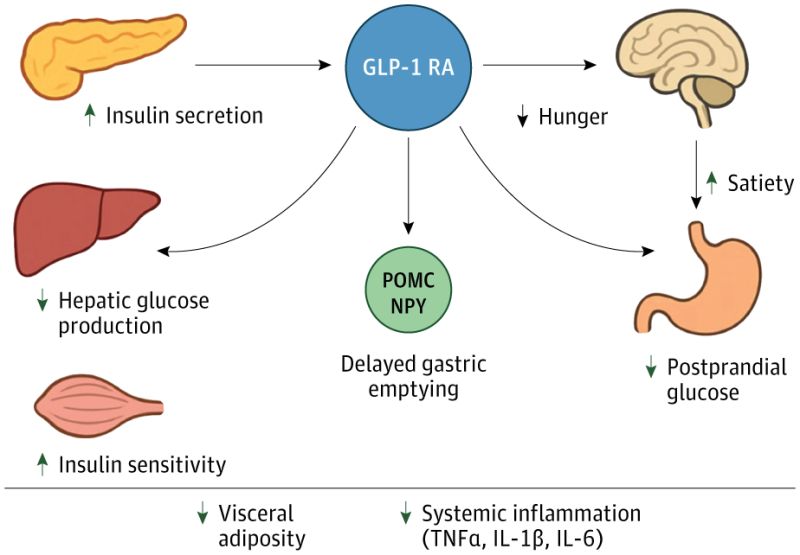 glp-1 psoriasis Drug Makes Its Case for Treating Plaque GLP-1 agonists reduce psoriasis severity