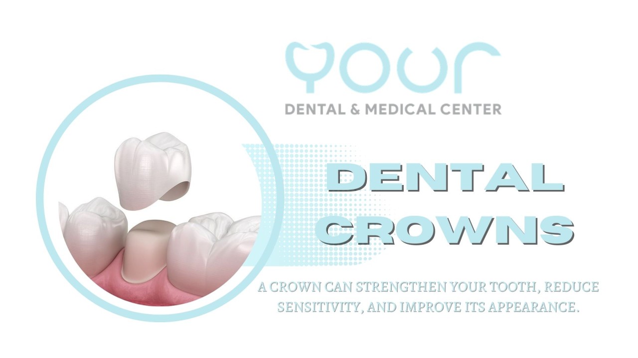 Dental Crowns Dental Crowns