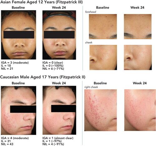 ghk-cu safety side effects Selected Biomarkers Revealed Potential Skin Toxicity Caused by Certain Copper Compounds what are the potential side