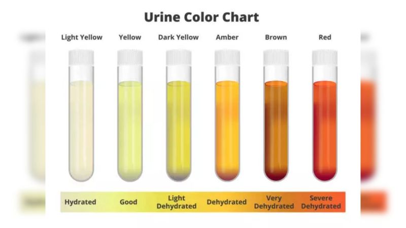 semaglutide yellow urine What is urine color? | Milan Panthi posted on the topic