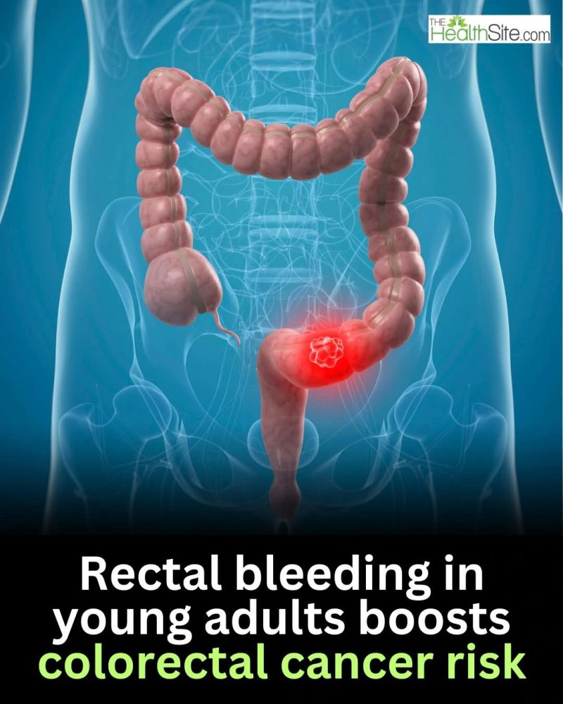 rectal bleeding semaglutide Rectal Bleeding: Causes, Symptoms & When to See a Doctor semaglutide and vaginal bleeding Abnormal Understanding Minor Rectal Bleeding -