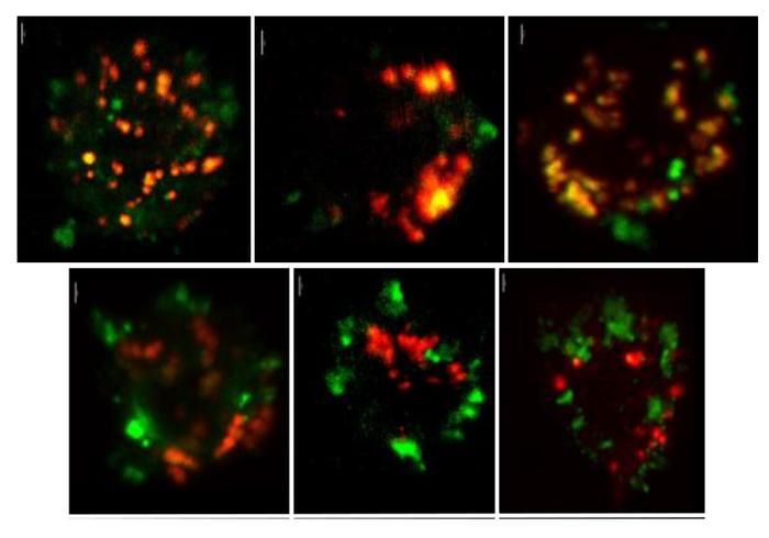 New Insights into Pathway That May Suppresses Autoimmunity Genetic New Insights into Pathway That May Suppresses Autoimmunity Genetic