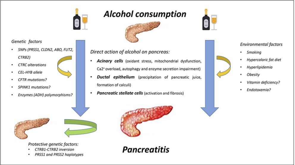 pancreatitis caused by semaglutide UK Probes Genetic Link Between Obesity Drugs and Acute Acute Pancreatitis Likely Due to