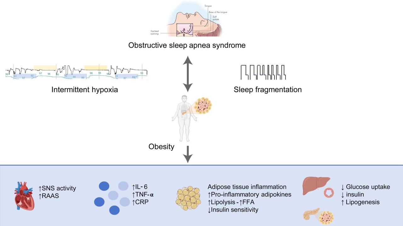 tirzepatide sleep apnea study How Zepbound Is Drawing Attention to Breakthrough Treatment for Obstructive Sleep