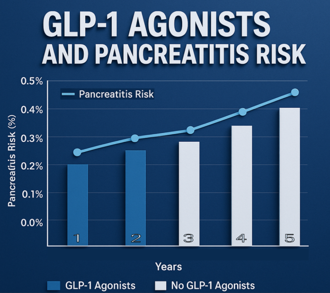 do glp 1 cause pancreatic cancer Glucagon-like Peptide Receptor Signaling in Acinar Cells Causes Growth-Dependent Release of Enzymes GLP-1 Agonists and Pancreatitis Risk: