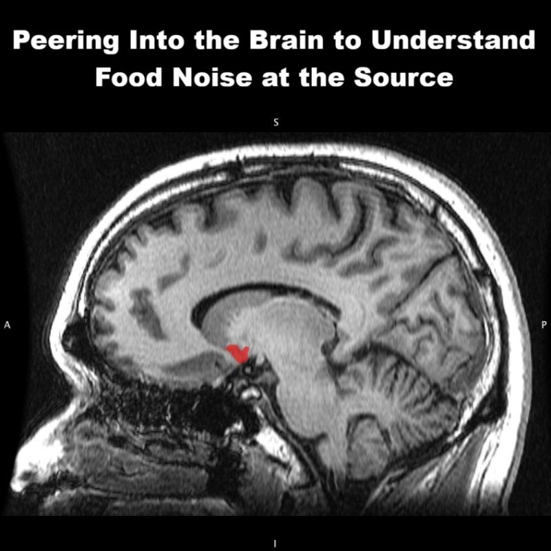 food noise coming back on tirzepatide and Noise: Clinical Evidence and Patient Experiences does tirzepatide help with food