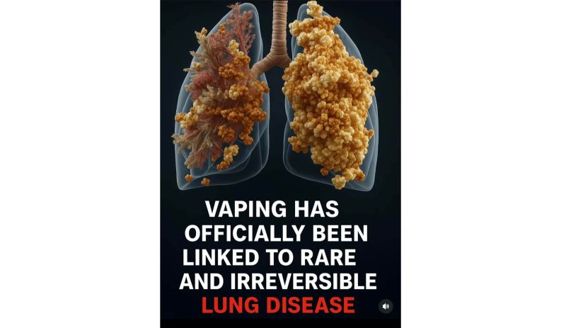 popcorn lung e cigarettes has been linked to the chemical found in e-cigarettes known as diacetyl. It causes coughing, wheezing and shortness of breath. Read more at https://t.co/P5hgfoIRFz #GetFitGP Some e-cigarettes contain chemicals that