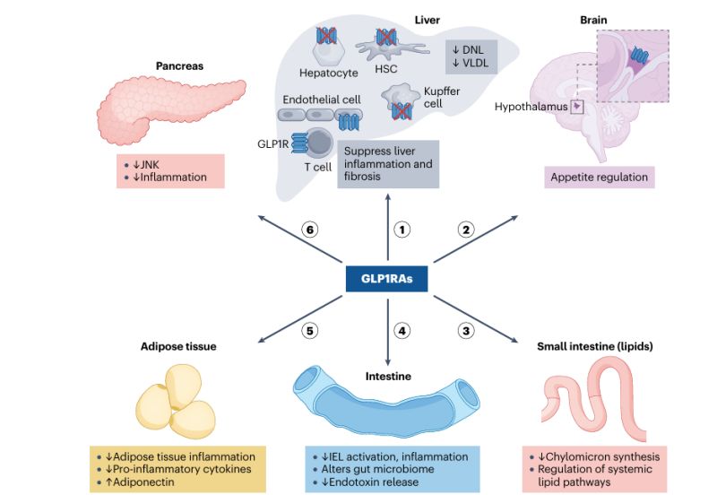 glp-1 masld Effect of pemvidutide, a GLP-1/glucagon dual receptor agonist, on MASLD: A randomized, double-blind, placebo-controlled study GLP1 MASLD MASH Treatment: A