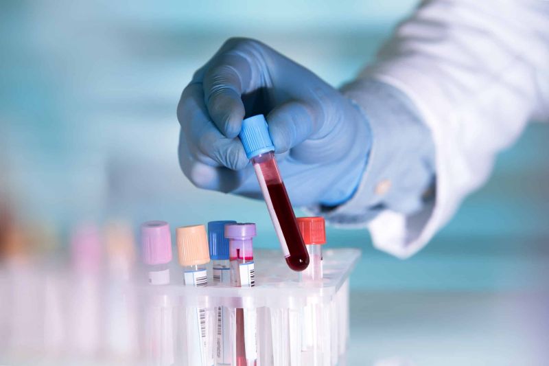 does semaglutide show up in a blood test FBI issues safety warning about counterfeit versions of weight loss drug Semaglutide and Blood Work: What