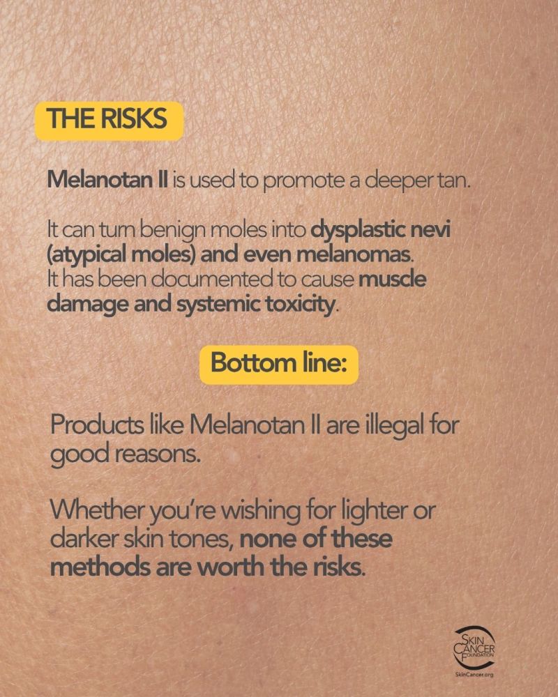 melanotan causes moles & Tanning Injections: Safe or Risky? Melanotan II (Tan Jabs): Why