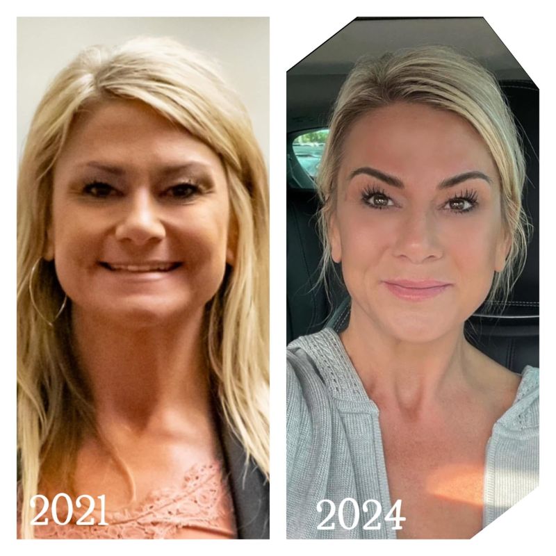 ghk cu alternative Are GHK-Cu Injections Safe Enough? Alternatives Options Neurogan Health GHK-CU - Research Peptide -