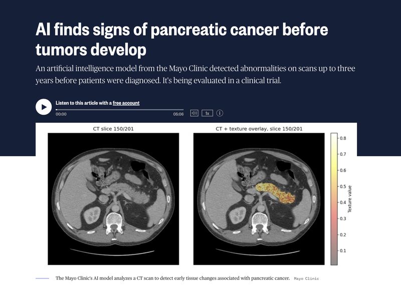 bpc 157 pancreatitis bpc-157 Therapy Effect of the Stable Gastric Pentadecapeptide on Acute as Vascular Failure-Induced Severe Peripheral and Central Syndrome in Rats bpc 157 pulmonary fibrosis Therapy Multifunctionality and Possible Medical Application