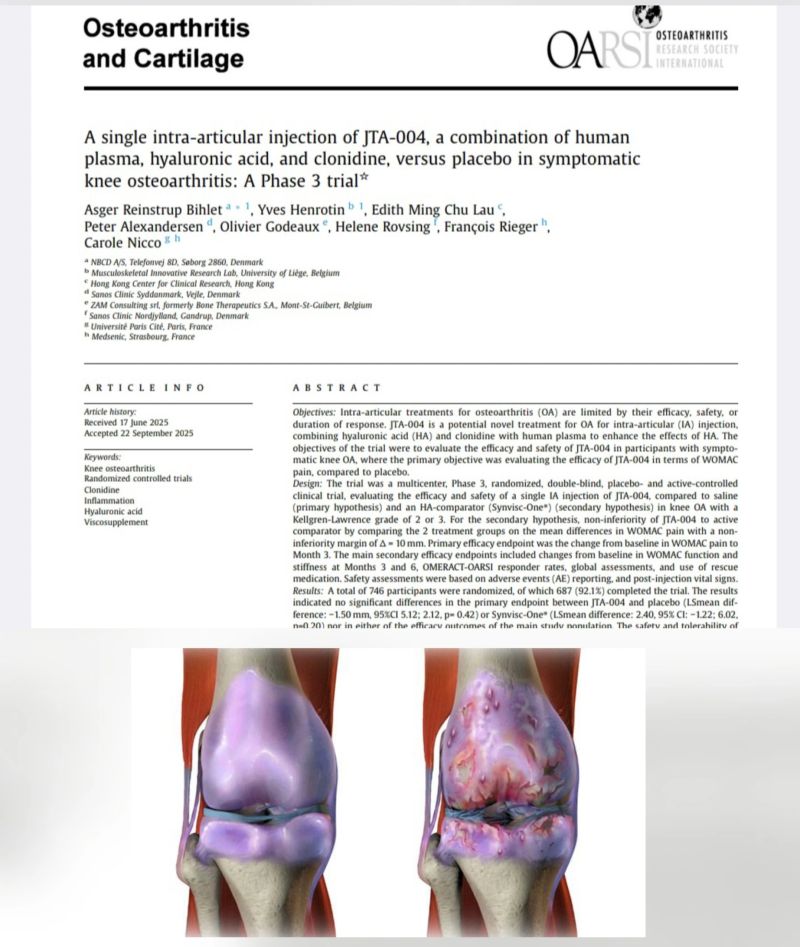 bpc 157 acl surgery Corrective ACL Surgery and Meniscus 3 Tear, this time with BPC-157 and TB-500 : r/ACL