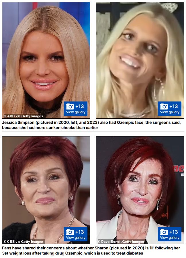semaglutide facial aging What Is 'Ozempic Face' and How To Prevent It Ozempic Face: The Dark Side