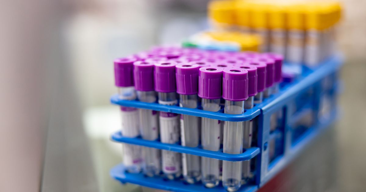 Cheryl Danke Lohman on LinkedIn: Long COVID Study Suggests Immune Cheryl Danke Lohman on LinkedIn: Long COVID Study Suggests Immune