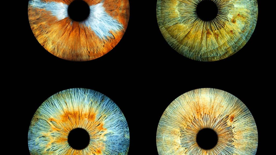 glp 1 vision changes Frontiers Morris - Seeing changes