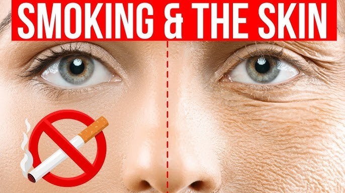 does smoking cigarettes dehydrate you Dry skin vs dehydrated skin. Do they mean the same thing? NOPE! Surprising!! Smoking Affects Your Looks