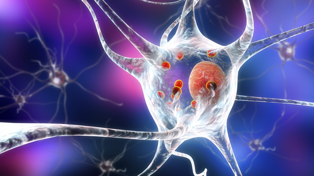 naion and glp 1 MD Groups Respond to Study Linking GLP-1 Treatment to Will Ozempic Make You Go