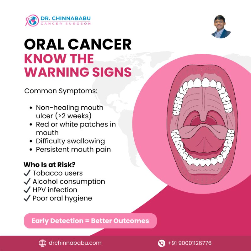 symptoms of mouth cancer due to tobacco Smoking causes Signs and symptoms of oral