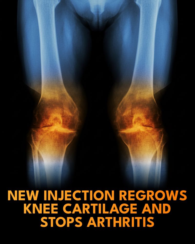 can bpc 157 regrow cartilage Have scientists just found a way to knee cartilage? BPC-157 Peptide Therapy | Regenerative