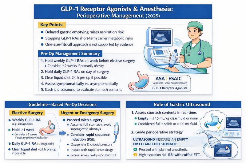 asa guidelines for glp-1 drugs glp 1 Holding Agonists Prior to Elective Procedures asa glp 1 guidelines The How should we approach patients