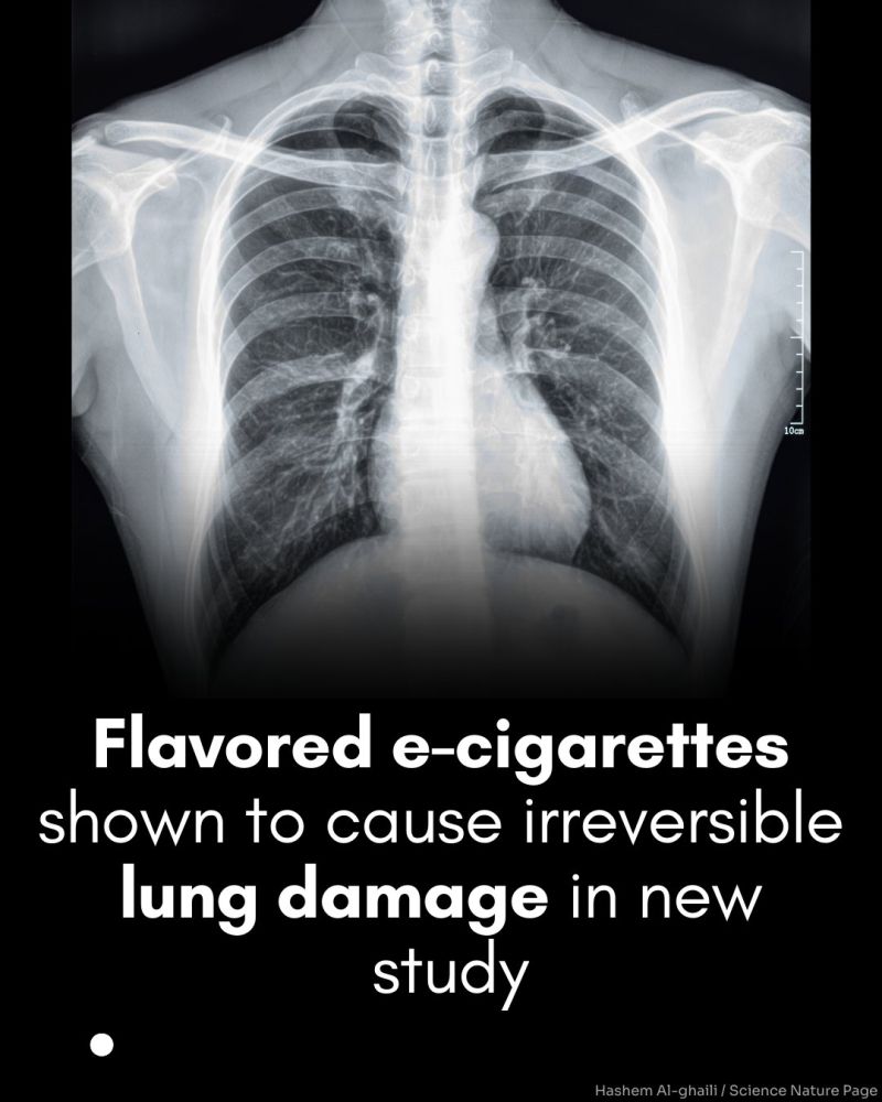 can you get popcorn lung from cigarettes What is Lung? iMaster Health Popcorn Lung: A Dangerous Risk